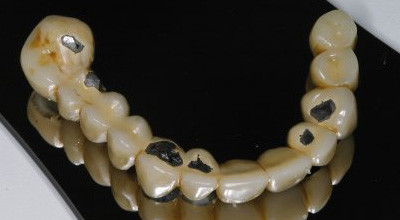 Die 3-D-gestützte Implantologie –  praxisnah und detailliert