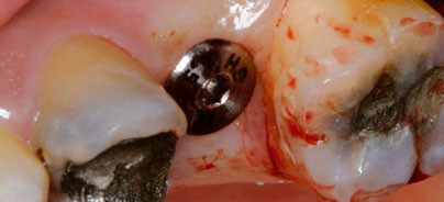 Win-win-Situation für Patient und Zahnarzt