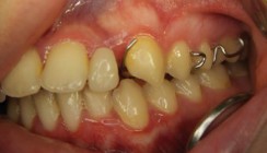 Von der Notwendigkeit der 3-D-Diagnostik