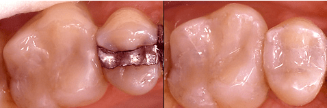 Was können moderne Komposite leisten?