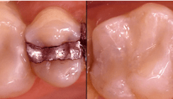 Was können moderne Komposite leisten?
