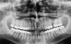 Kieferorthopädische Chirurgie und Ästhetik
