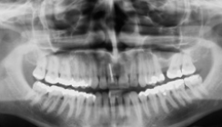 Kieferorthopädische Chirurgie und Ästhetik