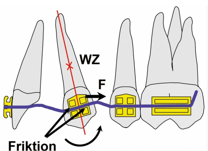 Bis zu 30 % weniger Friktion