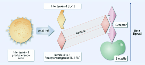 Parodontitis und Periimplantitis - ein Blick hinter die Kulissen