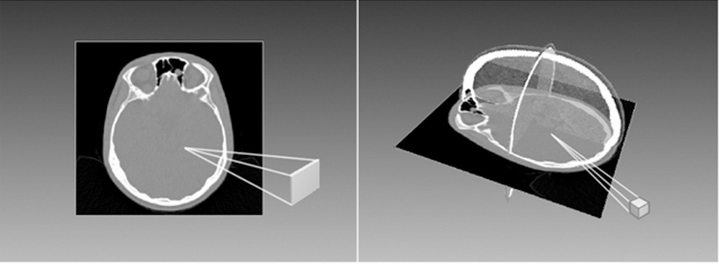 Die 3-D-Diagnostik in der Endodontie