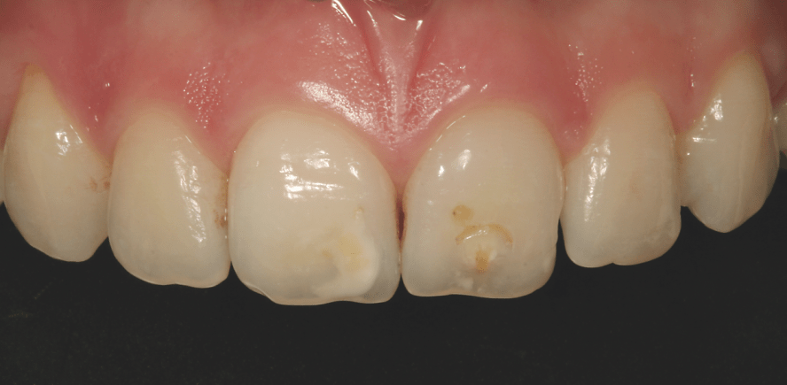 Ein bioökonomisch optimiertes Behandlungskonzept