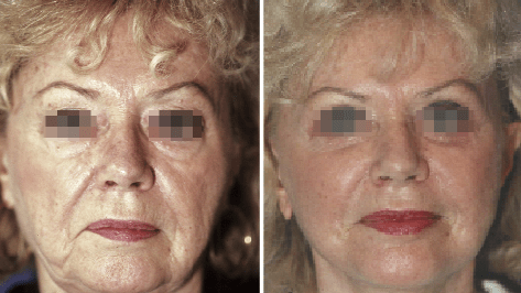 Das Altern – Wandlungen der Patientenansprüche