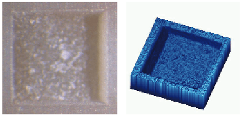 Ultrakurzpulslaser-Technologie in der Zahnheilkunde