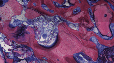 Optimale Knochenregeneration erreichen