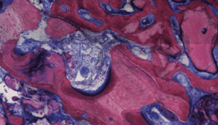 Optimale Knochenregeneration erreichen