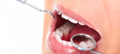 PAR/Dentalhygiene nach GOZ 2012