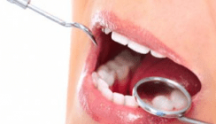 PAR/Dentalhygiene nach GOZ 2012