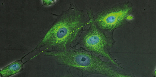 Mögliche Wege zum Bioengineering von Zahnkeimen