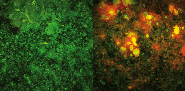 Dekontamination biofilmbesiedelter Implantatoberflächen