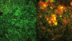 Dekontamination biofilmbesiedelter Implantatoberflächen