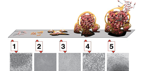 Folgen einer unzureichenden Therapie und Prophylaxe