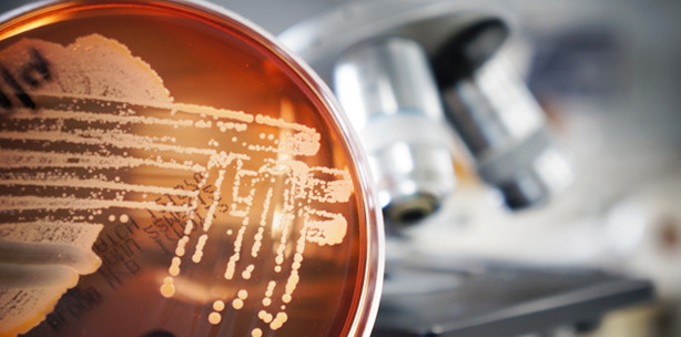 Neue Erkenntnisse über die Entstehung von Biofilmen