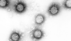 Biomarker für virusbedingten Krebs im Rachenraum gefunden
