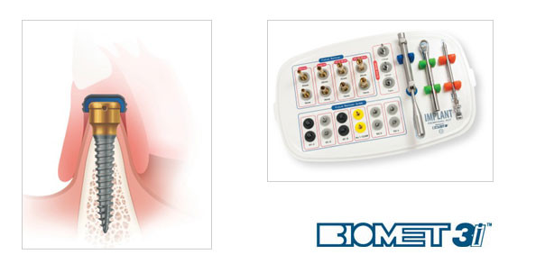 BIOMET 3i kündigt neue Produkte im strategischen Portfolio an