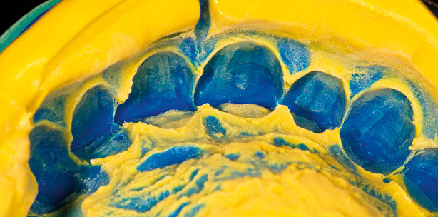 Material auf Bis-Acrylat-Basis