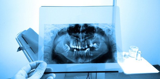 Bisphosphonat: Risiken abwägen und Patienten aufklären