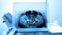 Bisphosphonat: Risiken abwägen und Patienten aufklären