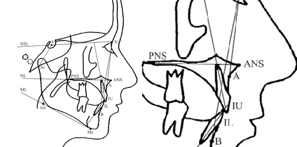 Bisskraft, Stabilität und FKO-Apparaturen