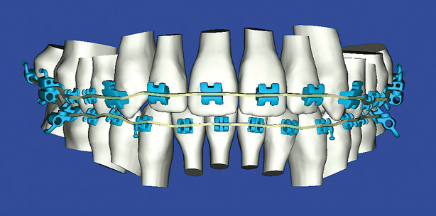 Hightech-KFO höchster Präzision (1)