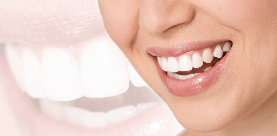 Bleaching-Behandlungen fördern Umsatz und Image