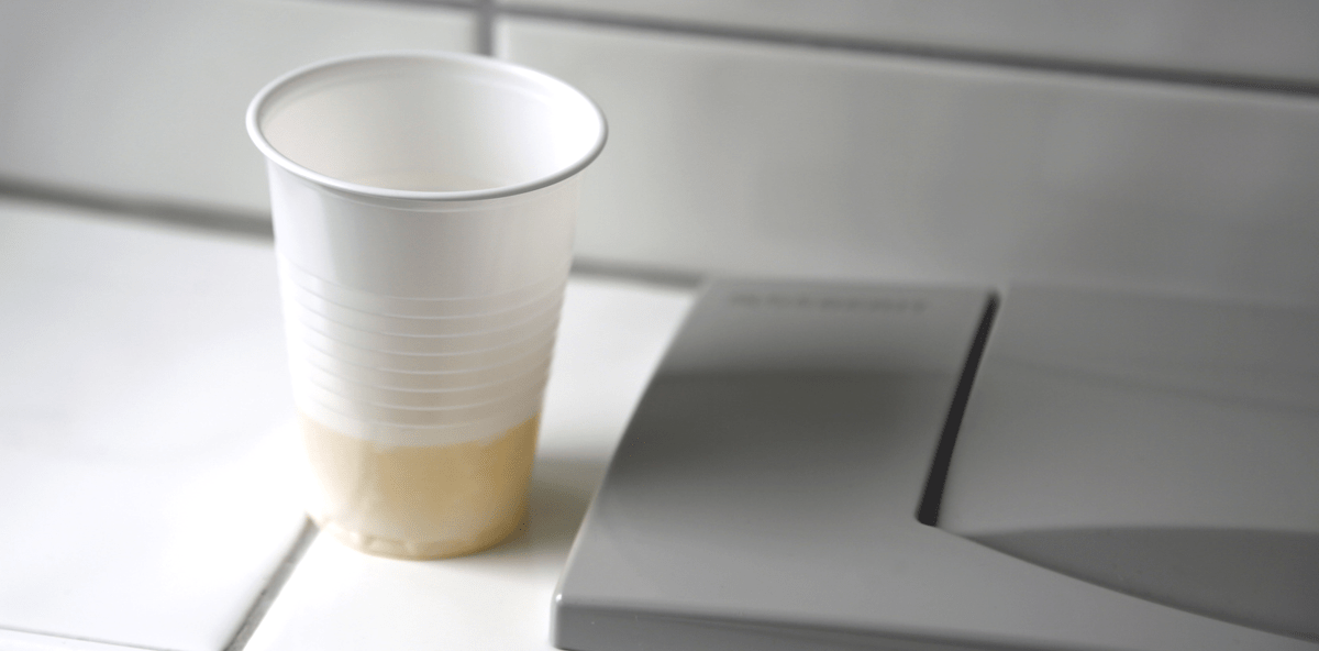 Fragwürdiges Experiment: Urin gurgeln für weißere Zähne?!