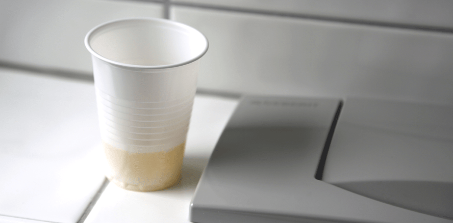 Fragwürdiges Experiment: Urin gurgeln für weißere Zähne?!