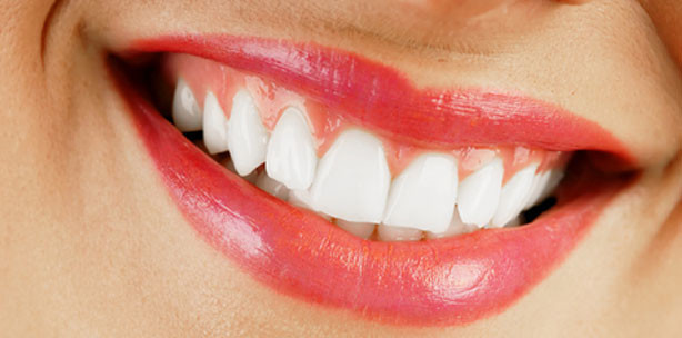 Strahlende Zähne – immer gefragt