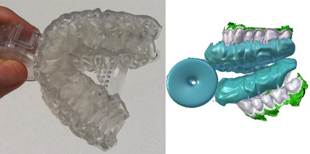 Saubere Zähne in sechs Sekunden