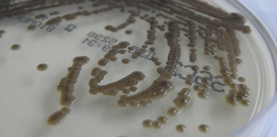 Aquatischer Biofilm, Pilzflora und Reparaturkosten in Dentaleinheiten