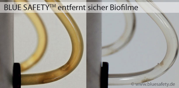 Hygienische Sicherheit für Behandlungseinheiten