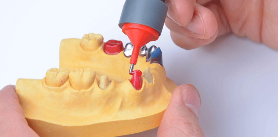 Höhle der Löwen: Zahntechniker überzeugt mit universellem Komposit