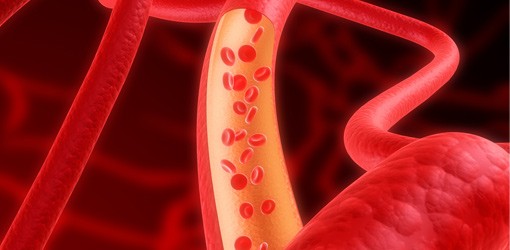 Symptome des von-Willebrand-Syndroms abfragen und Blutungsrisiken vermeiden