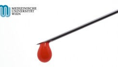 Allergien frühzeitig erkennen: Ein Blutstropfen genügt
