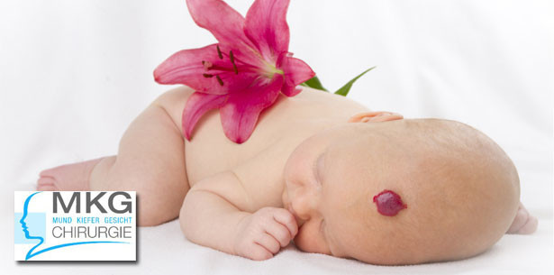 Bessere Heilungschancen für Gesichtstumore bei Kindern