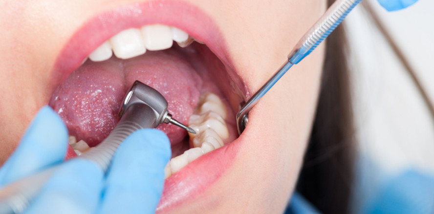 Nie wieder Bohren? Flüssigkeit behandelt Löcher ohne Schmerzen