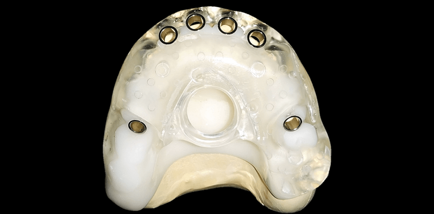 Wie ist die Genauigkeit von Bohrschablonen einzuschätzen?