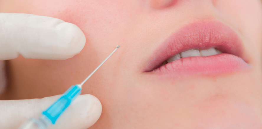 Spritzen gegen Zähneknirschen: Botox greift Kieferknochen an