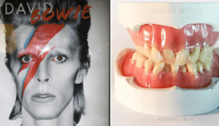 David Bowies Zähne nachmodelliert