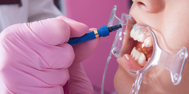 1,3 Mrd. Euro umgesetzt: Britische Zahnärzte kassieren ab