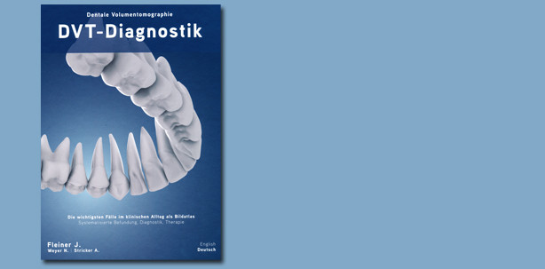 Neue Fachliteratur zur dentalen Volumentomographie