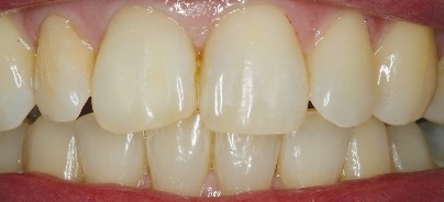 Endodontie im demografischen Wandel