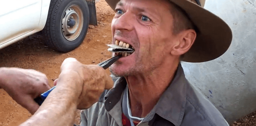 Ein Zahnarzttermin im Outback ...