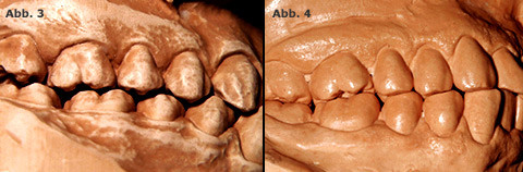 Vorsprung durch Zahntechnik