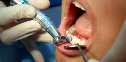 Zahnbetterkrankung "Parodontitis"  - Akademietag bietet praktische Tipps für Patienten